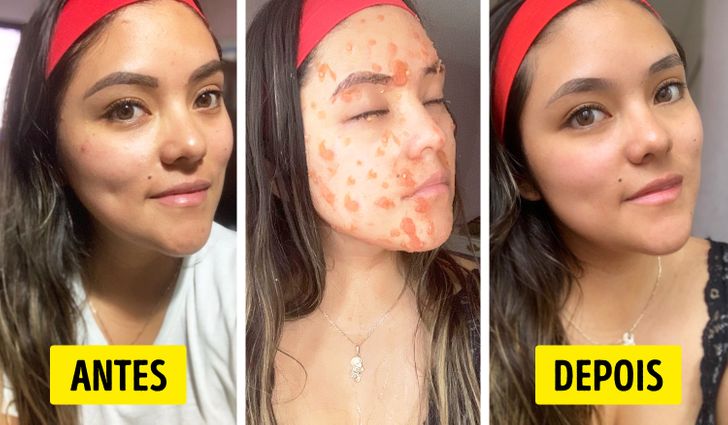 benefícios do tomate para a pele