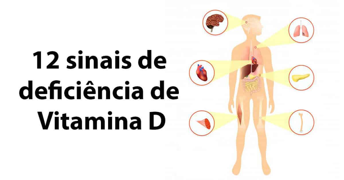 CID-10 E55: Entenda a Classificação da Deficiência de Vitamina D; Raquitismo Ativo (E55.0): O Que Você Precisa Saber Sobre a Deficiência de Vitamina D em Crianças; Deficiência Não Especificada de Vitamina D (E55.9): Causas