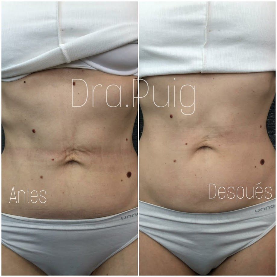 Guia completo: Como escolher o melhor colágeno para você