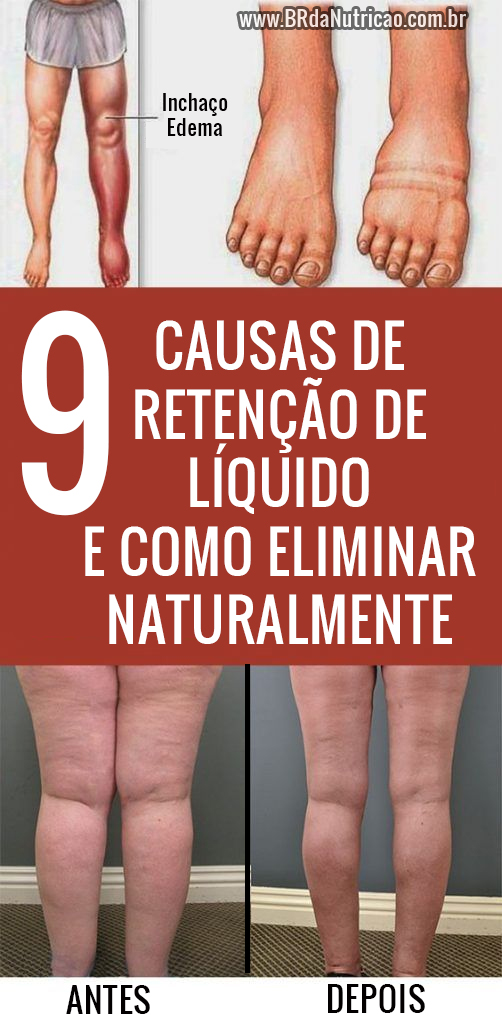 O Guia Completo de Alimentos que Ajudam a Desinchar