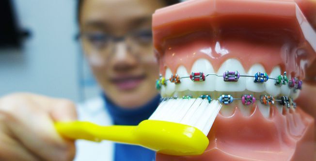 Guia Completo de Fio Dental com Aparelho