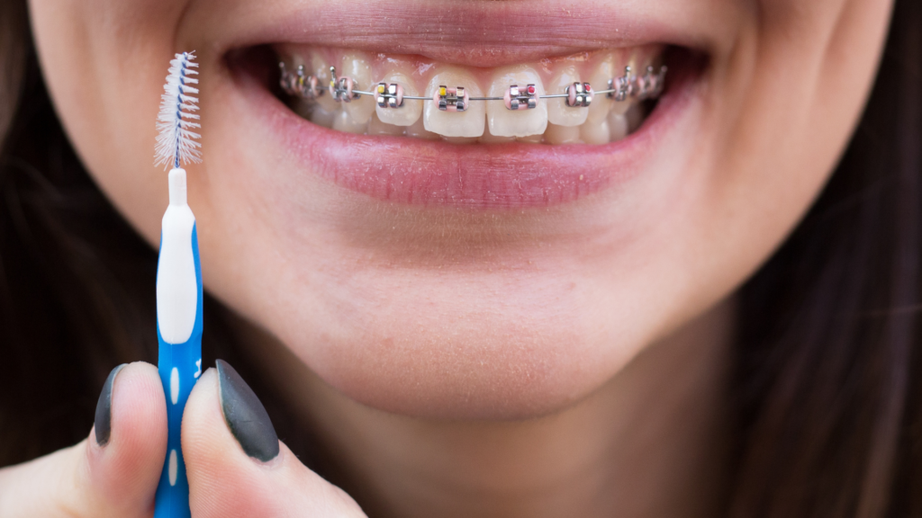 O Que Fazer em Caso de Desconforto Pós-Manutenção do Aparelho