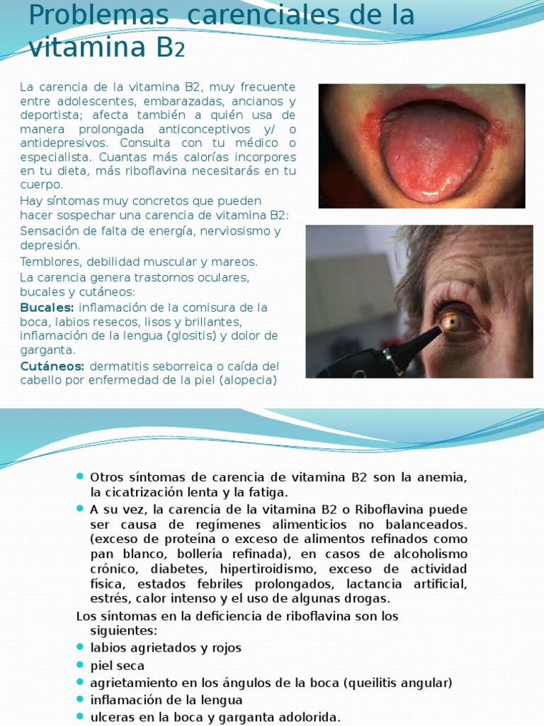 Vitamina B2 e a Saúde Ocular: O Que Você Precisa Saber