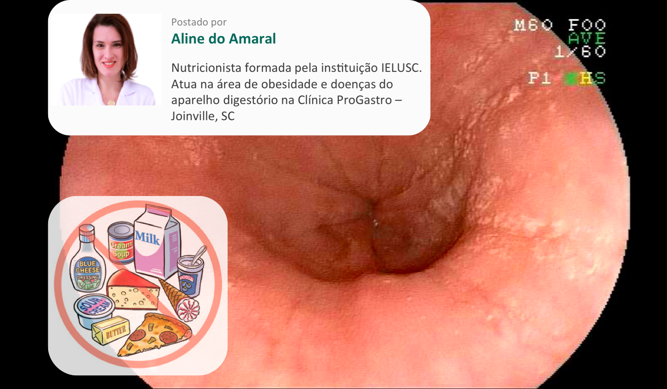 Como a Dieta Elemental Funciona para Casos Severos de EoE