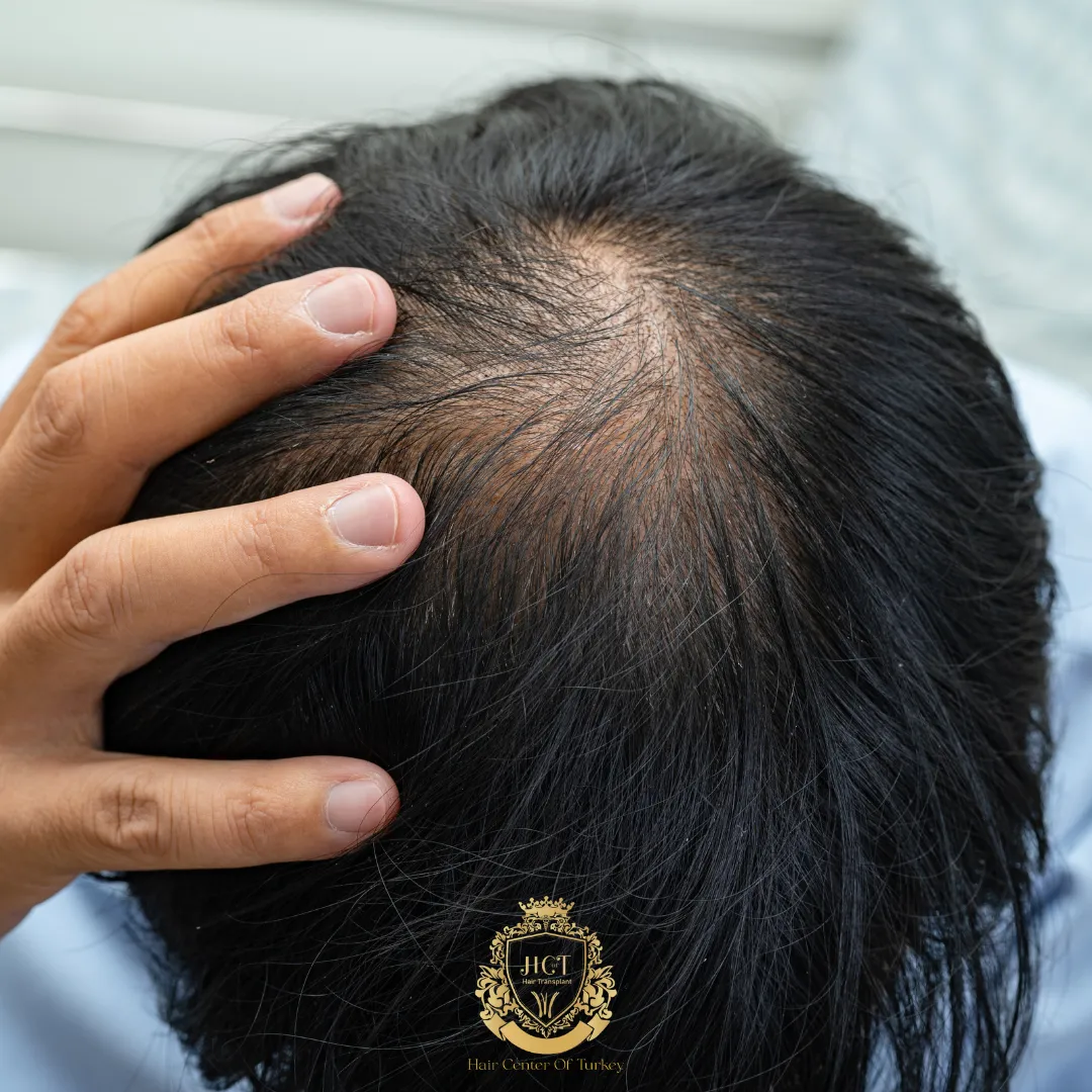 Guia Completo de Vitaminas Essenciais para Cabelos Fortes