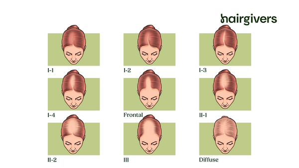 Os Perigos das Dietas Restritivas para a Saúde Capilar