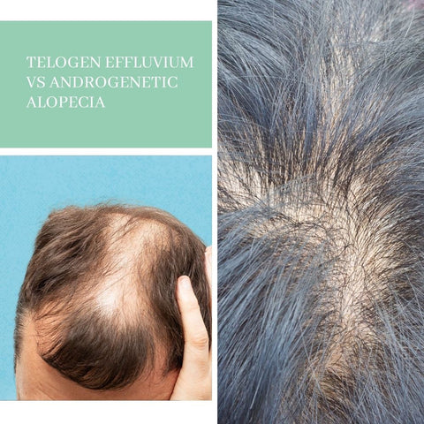 dieta para quem tem telogen effluvium