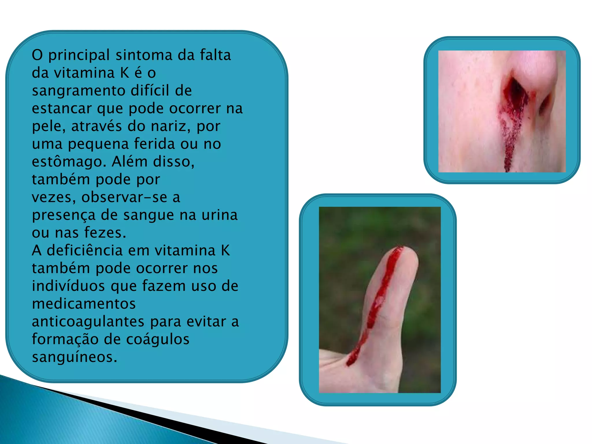 doenças causadas pela falta de vitamina k