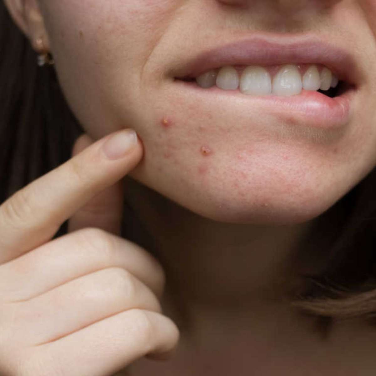 lista completa efeitos colaterais vitamina b12