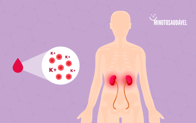 excesso de potássio no sangue