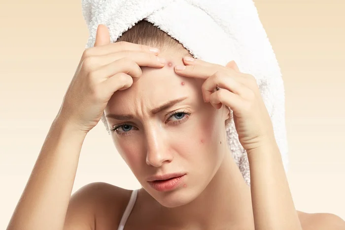 Doses Seguras de Vitamina B12 para Evitar Acne