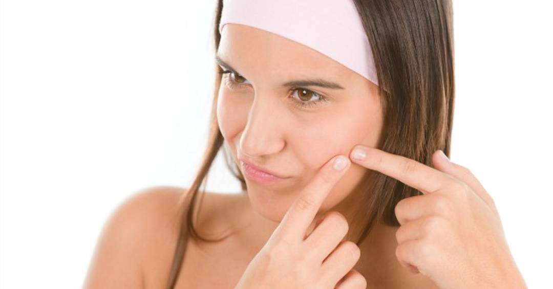 Tratamentos para Acne Induzida por Suplementos