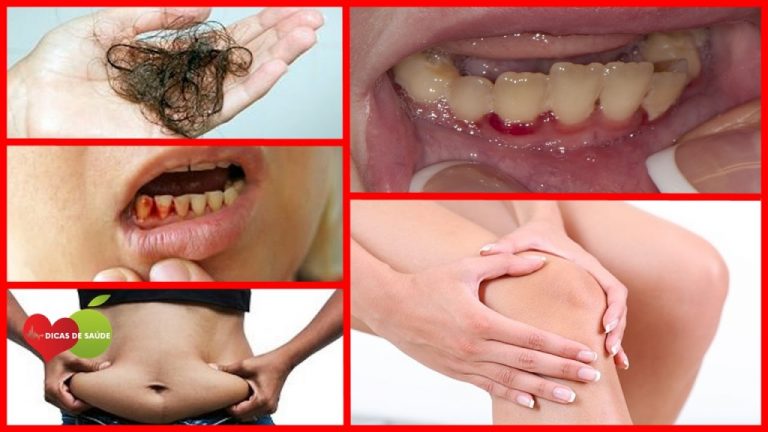 A Relação Entre Vitamina C e Saúde Renal: O Que Você Precisa Saber