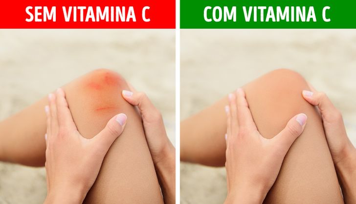 Como a Vitamina C Afeta a Absorção de Outros Nutrientes