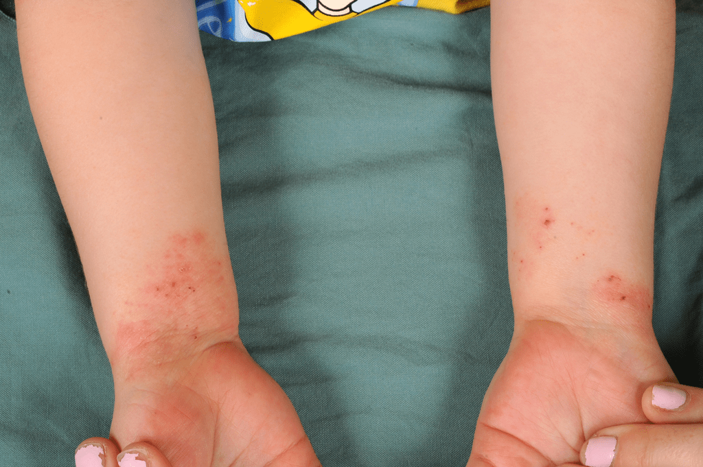 O zinco afeta o sistema imunológico?