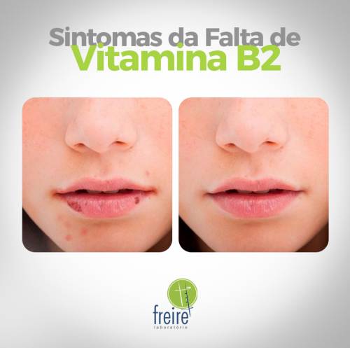 falta de vitamina b12