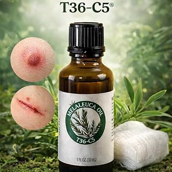 5 Usos do Óleo de Melaleuca na Horta Orgânica