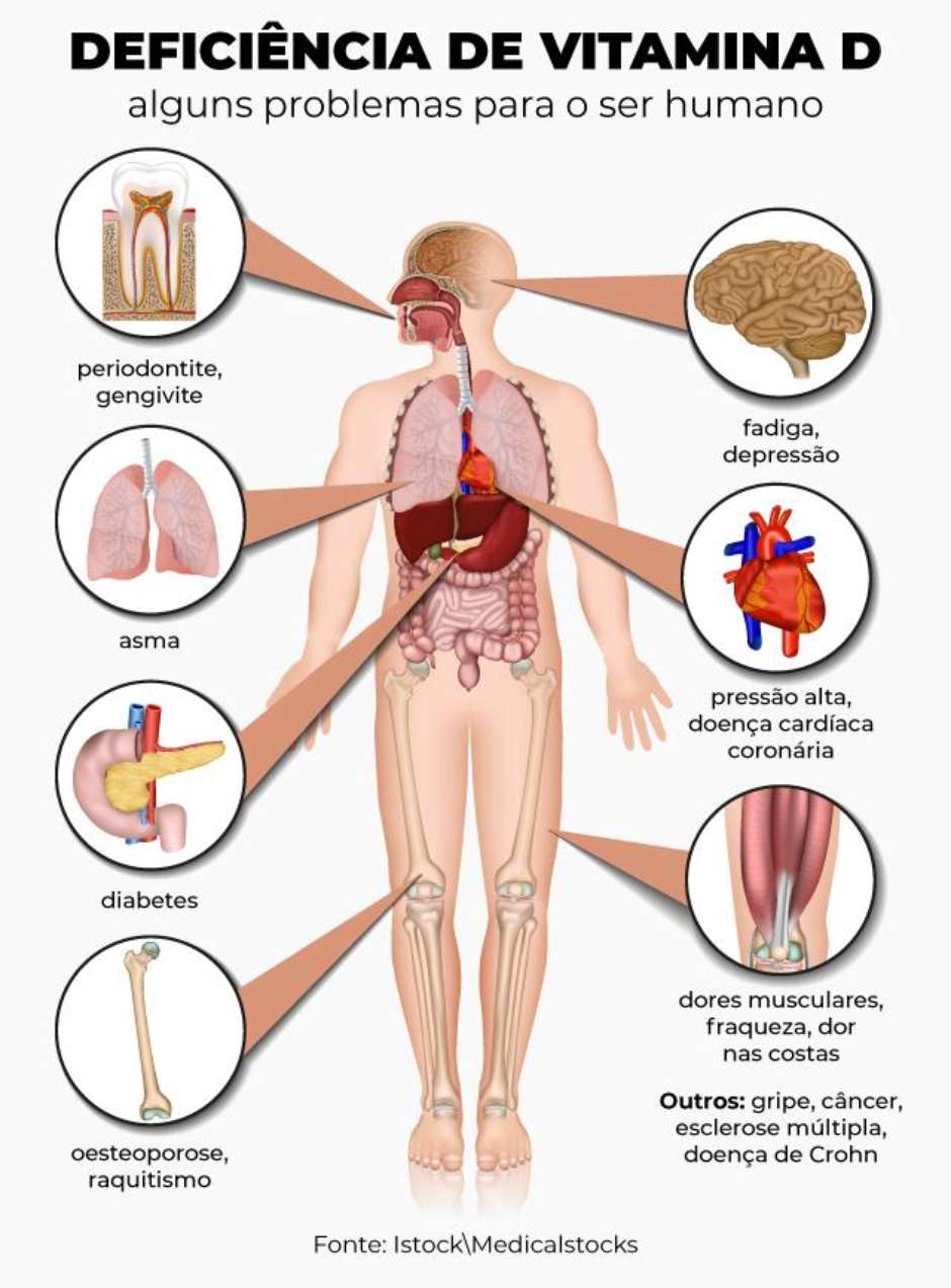 erros comuns ao tentar aumentar vitamina D