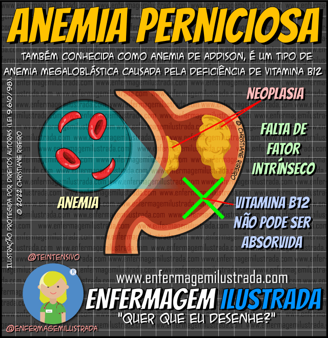 Anemia Perniciosa: Entenda a causa autoimune da falta de B12