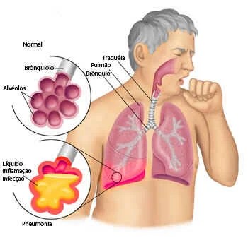 1. Legionella vs. Esporotricose: Entenda as Diferenças Cruciais; 2. Guia Completo de Equipamentos de Proteção Individual para Jardineiros; 3. Como a Umidificação do Solo Reduz Riscos na Jardinagem; 4. Os Sintomas da Doença do Legionário e Quando Procurar Ajuda Médica; 5. Dicas Essenciais de Higiene para Amantes de Plantas