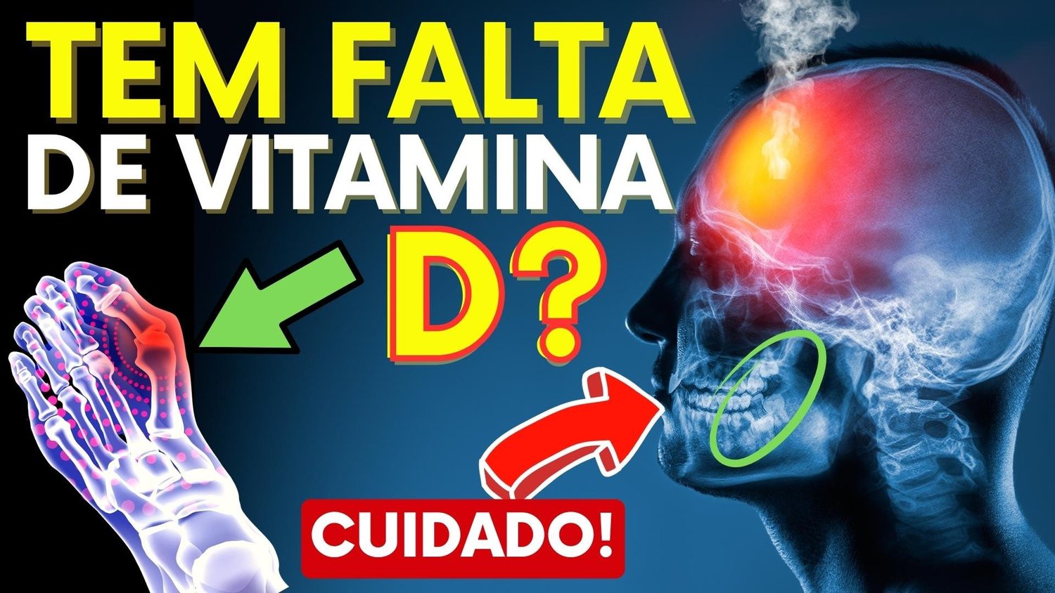 5 ideias de títulos:
1. Deficiência de Vitamina D: Guia Completo de Sintomas e Diagnóstico
2. Como a Falta de Vitamina D Afeta seu Corpo: Sinais de Alerta
3. Vitamina D: Entenda os Riscos da Deficiência e Como Tratar
4. Os 7 Sintomas Mais Comuns da Deficiência de Vitamina D
5. Vitamina D Baixa: O Que Fazer Para Normalizar os Níveis?