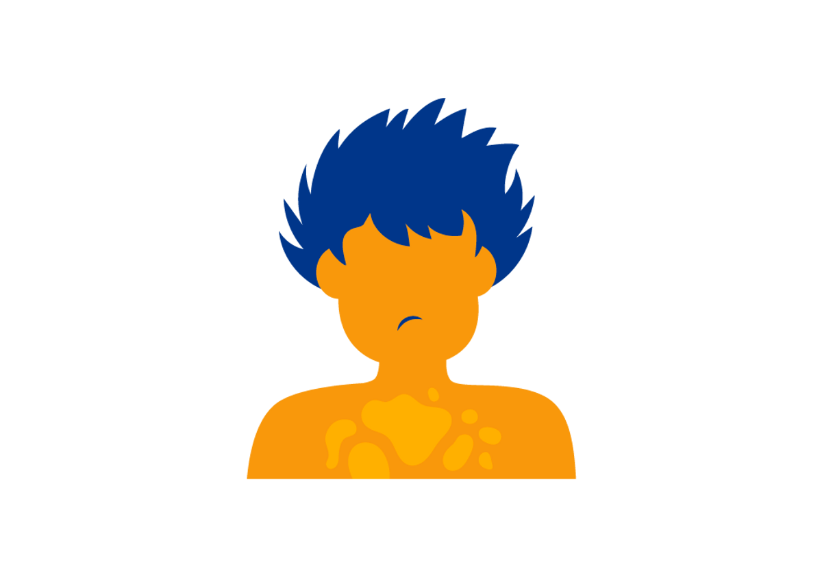 Osteoporose: Um Sinal de Deficiência de Cobre?