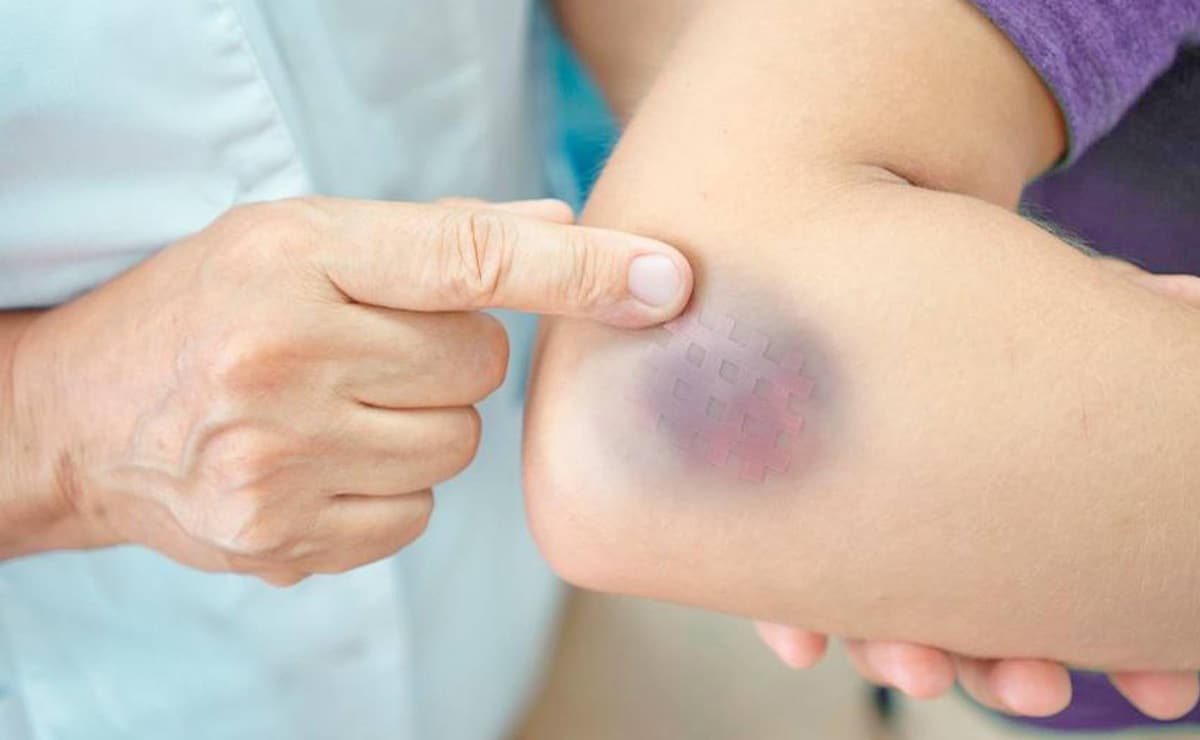 Fontes alimentares de Vitamina K