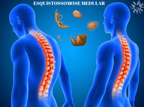 Guia Completo: Como Prevenir e Tratar Verminoses em Adultos