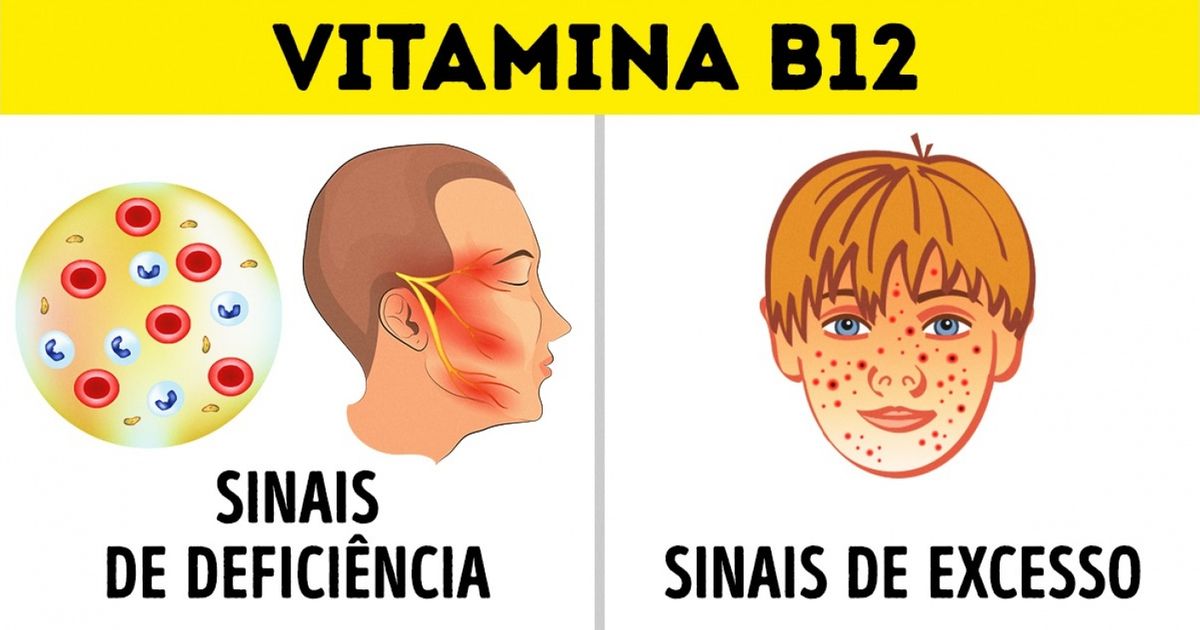 sintomas excesso vitamina b12