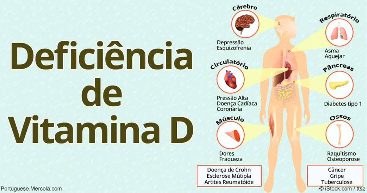 Hipercalcemia: Entenda a Relação com o Excesso de Vitamina D e Seus Riscos