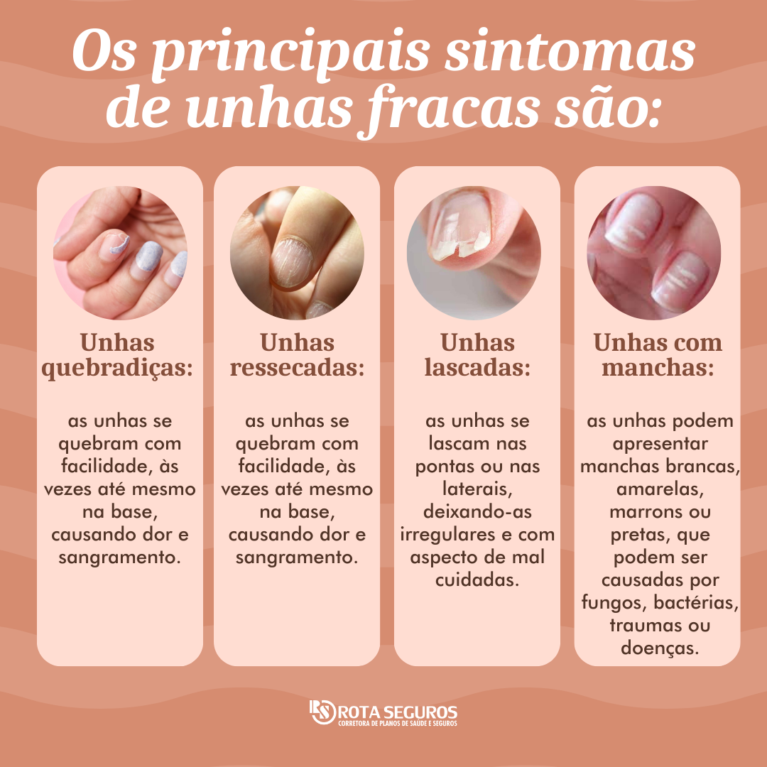 unhas fracas e quebradiças o que pode ser