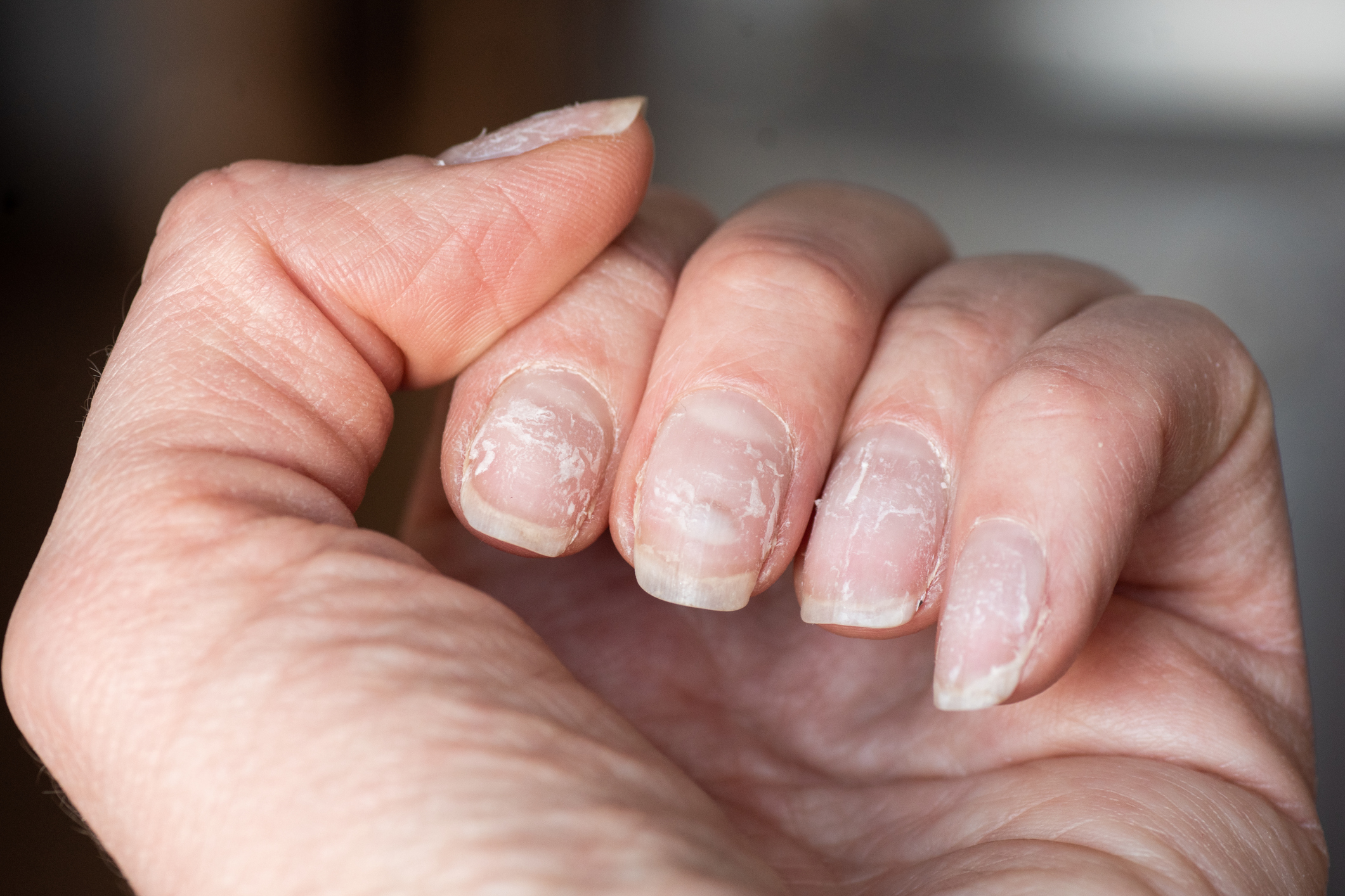 vitamina para fortalecer unhas