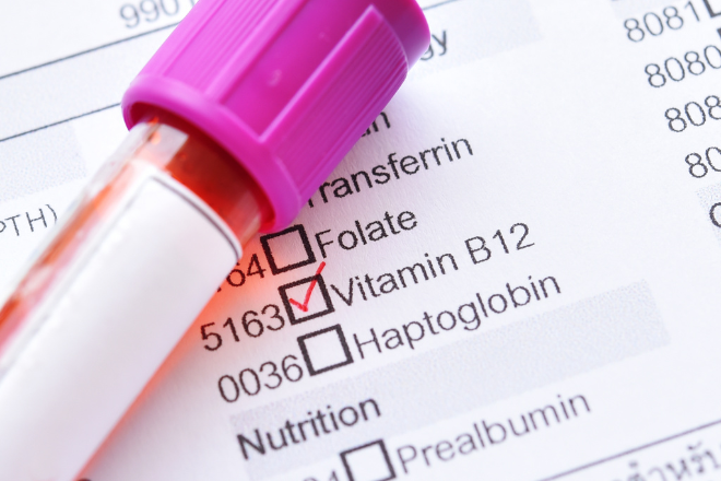 preço exame vitamina b12 laboratório