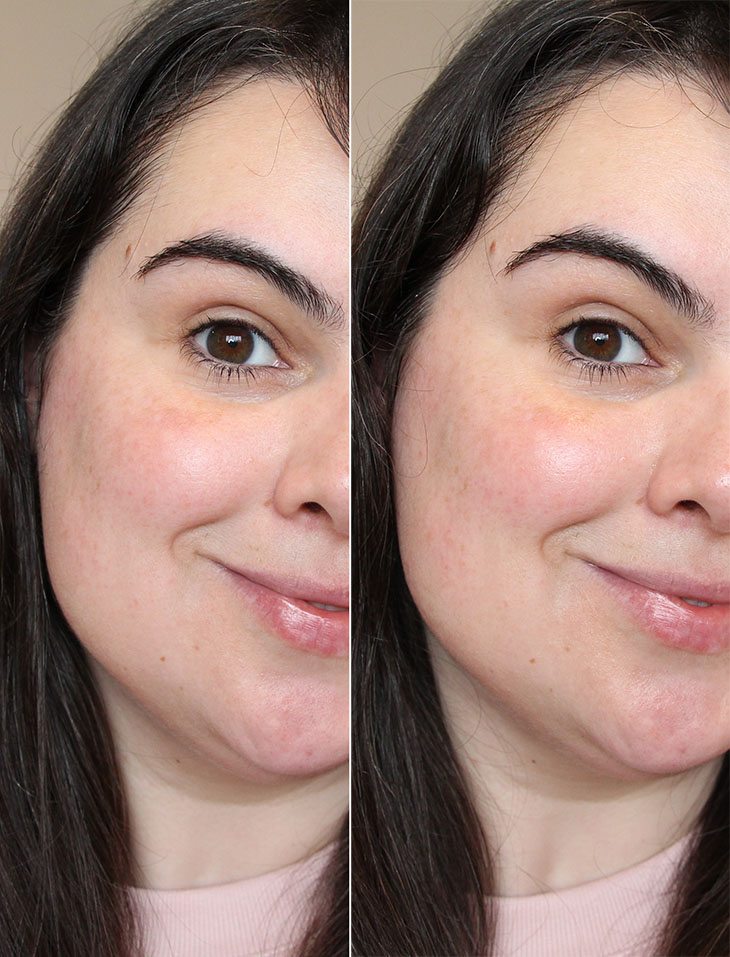 Comparativo de Preços: As Melhores Ofertas de Vitamina C do Mercado