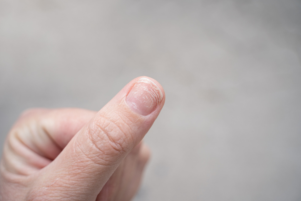 melhores vitaminas para cabelo e unha