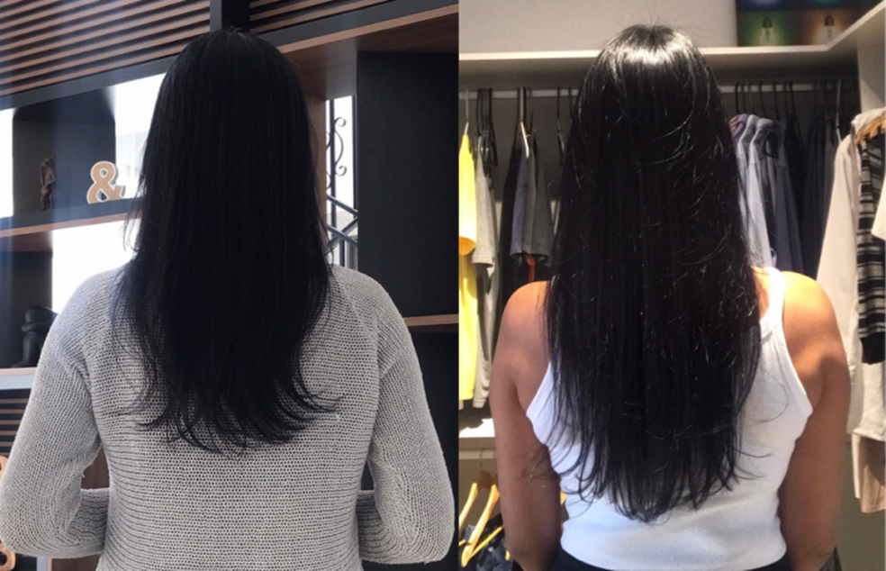 vitamina b12 cresce cabelo