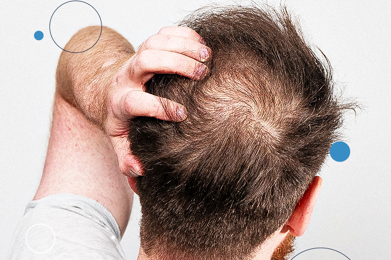 vitamina b12 cresce cabelo