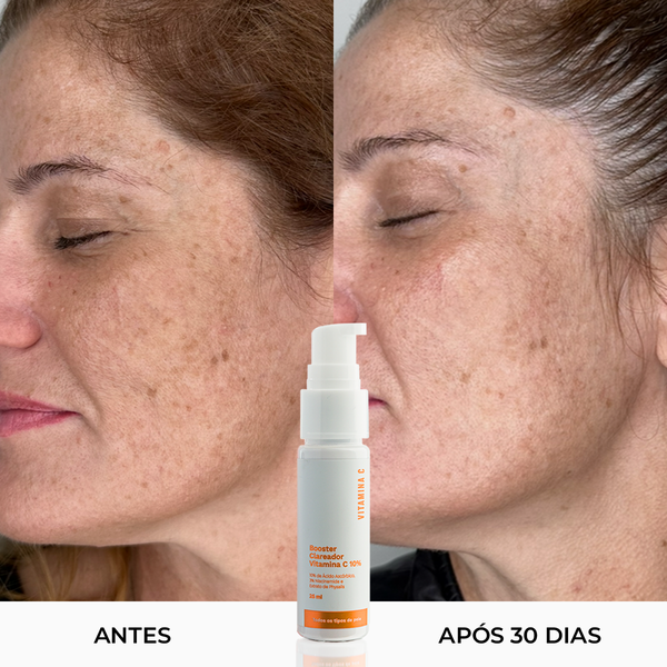 como usar vitamina c no rosto