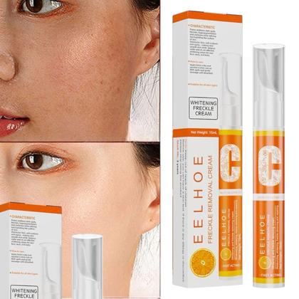 vitamina c tira manchas