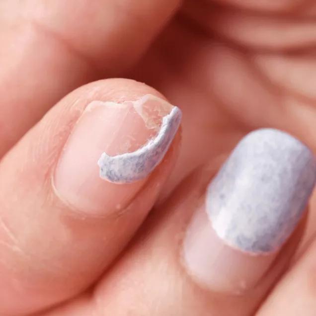 Zinco e Ferro: A Dupla Essencial para Unhas Fortes e Saudáveis